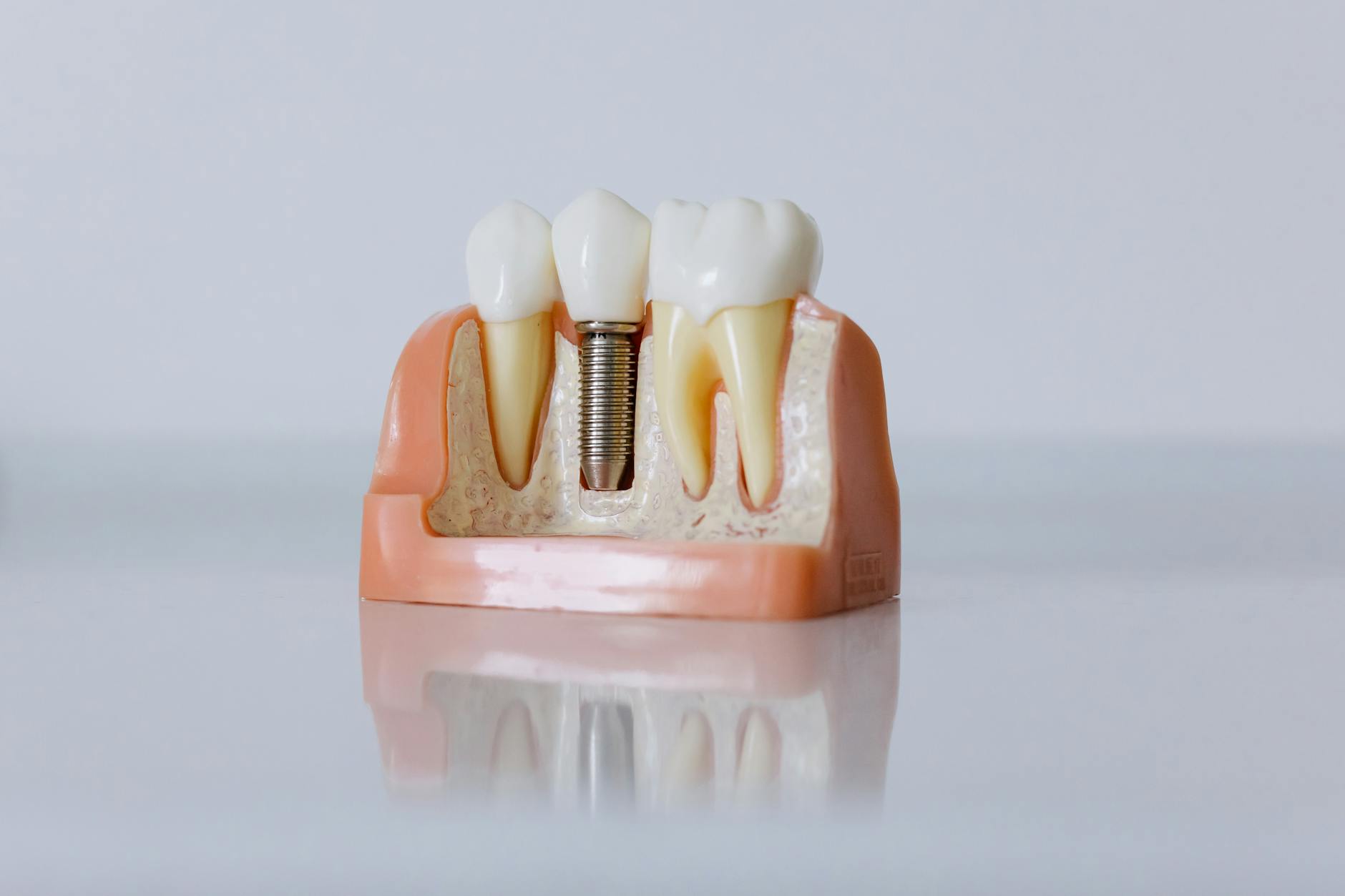 किंग सिटी, ओंटारियो में डेंटल इम्प्लांट: मुस्कान का स्थायी समाधान — Dentistry context photo for किंग सिटी, ओंटारियो