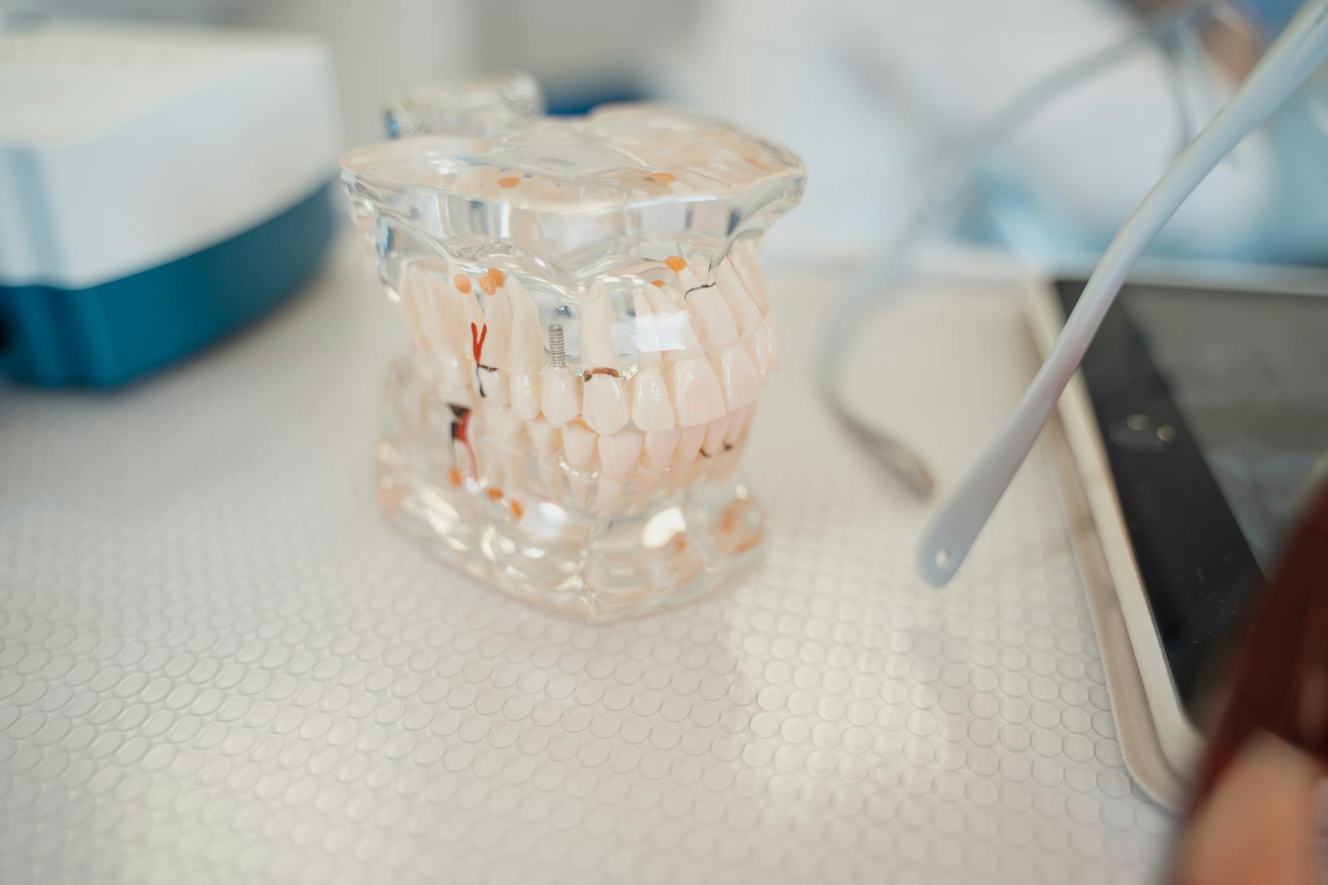 सही मुस्कान वापस पाएं: ऑरोरा, ओंटारियो में डेंटल इम्प्लांट्स — Dentistry context photo for ऑरोरा, ओंटारियो
