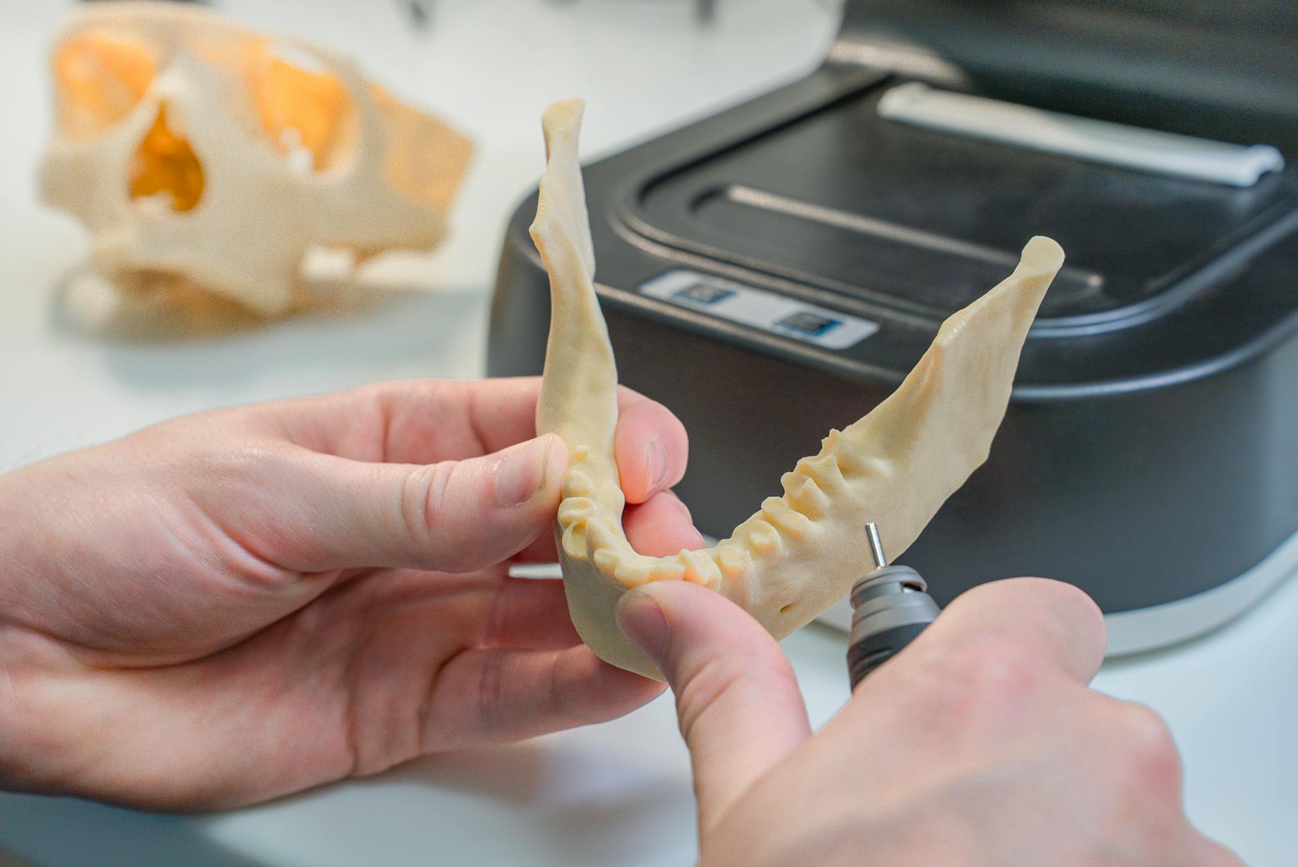 डेंटल इम्प्लांट्स: ऑरोरा, ओंटारियो में स्थायी मुस्कान — Dentistry context photo for ऑरोरा, ओंटारियो