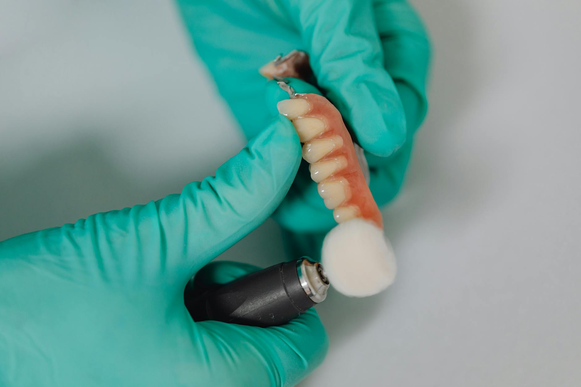ईस्ट ग्विलिमबरी में डेंटल इम्प्लांट्स: खोये दांतों का स्थायी समाधान — Dentistry context photo for ईस्ट ग्विलिमबरी, ओंटारियो