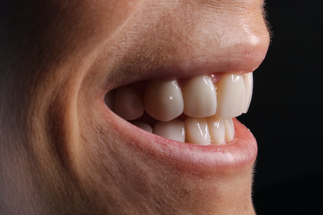 چرا ایمپلنت دندان دنوست در مارکهام، انتاریو بهترین راه حل دائمی است؟ — Dentistry context photo for مارکهام، انتاریو, 