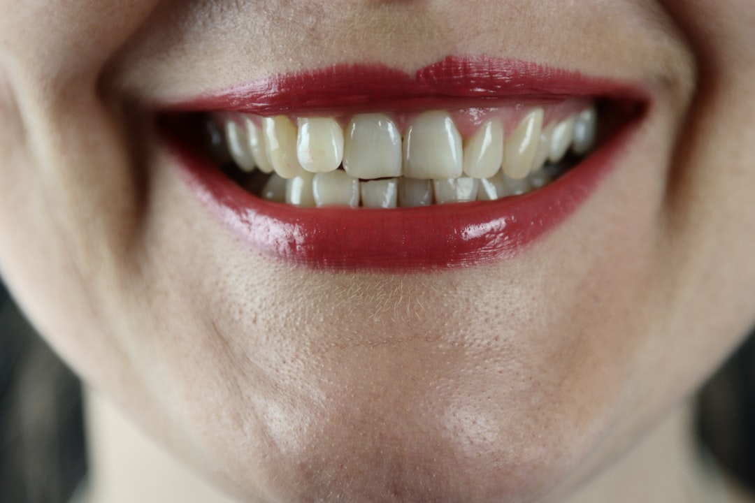 چگونه دنوست لبخند شما را در کینگ سیتی، انتاریو با زیبایی دندان متحول میکند؟ — Dentistry context photo for کینگ سیتی، انتاریو, چگونه دنوست لبخند شما را در کینگ سیتی، انتاریو با زیبایی دندان متحول میکند؟ — Dentistry context photo for کینگ سیتی، انتاریو,