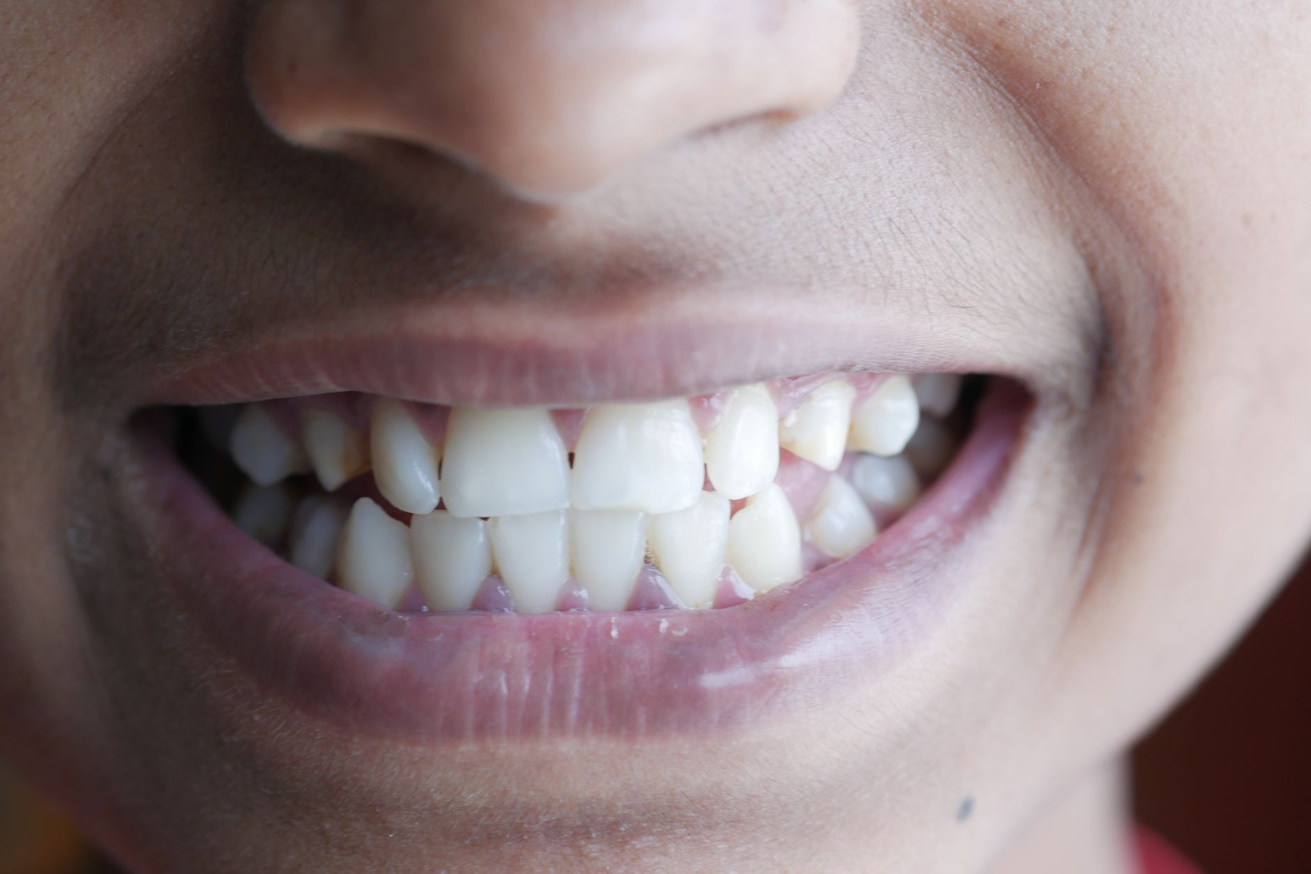 بهترین دندانپزشکی زیبایی در Vaughan برای لبخندی جذاب 2026 — Dentistry context photo for وaughan, انتاریو